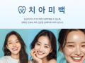 🦷 강남치과 치아미백, 치료 전에 꼭 알아두면 좋은 핵심 안내